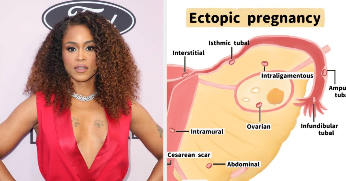 Eve Reveals She Had Ectopic Pregnancy